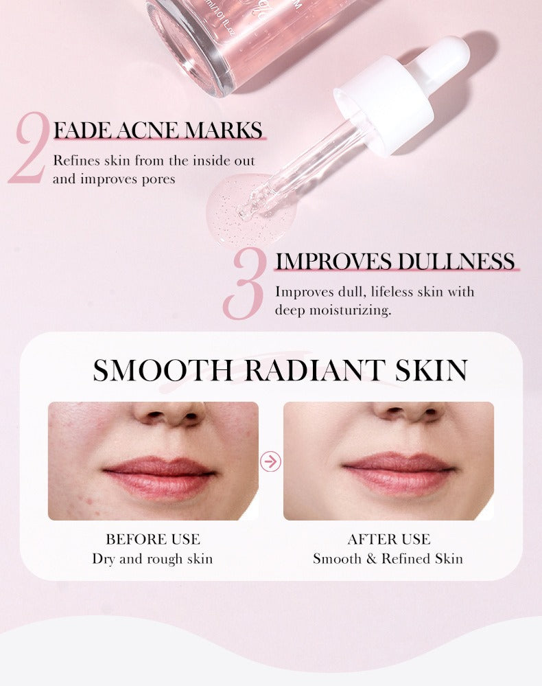 Anua Wonder Peach 70% Niacinamide Serum – Brightening & Pore Care