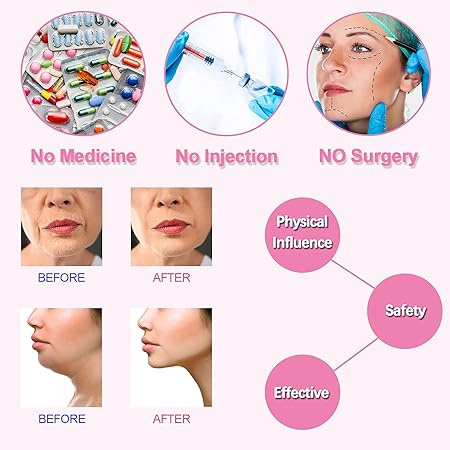 V-Shape Face Slimming Strap – Double Chin Reducer & Skin Firming Belt