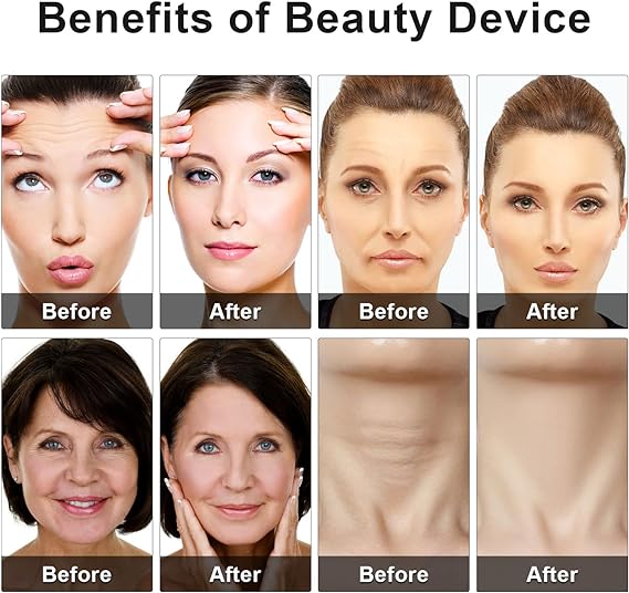Eye Beauty Device | Anti-Aging Massager for Dark Circles & Puffiness